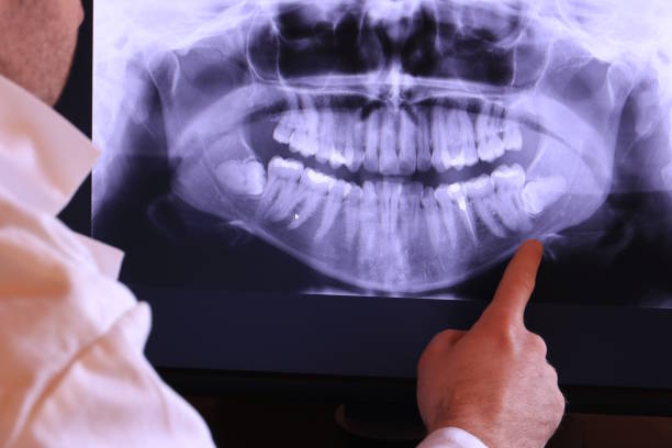 Best Emergency Dental Care for Trauma or Injury in Lake Hopatcong, NJ